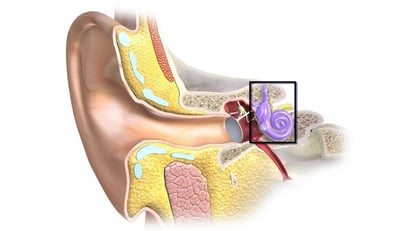 Síndrome de Ménière: qué es, síntomas, causas y tratamientos actuales