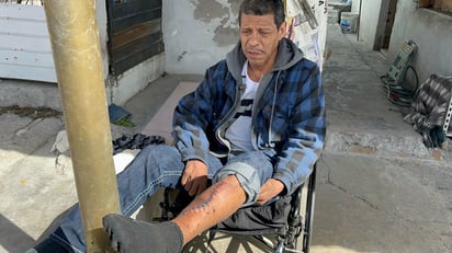 SOLIDARIDAD José Luis Valdez Almaguer solicita apoyo tras sufrir fractura expuesta en accidente automovilístico; autoridades lo responsabilizaron y el responsable incumple
