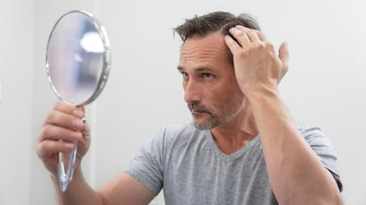 Células madre para la caída del cabello: qué dice la ciencia sobre su efectividad