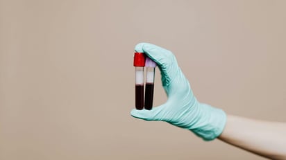 Un análisis de sangre puede predecir la supervivencia a corto plazo entre los mayores