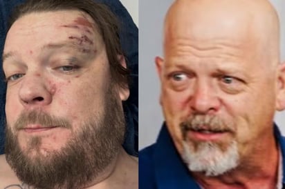 Rick Harrison