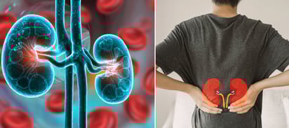 ENFERMEDADES ENFERMEDADES