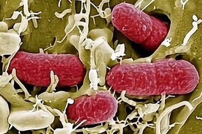 E. coli E. coli