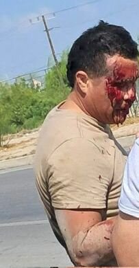seguridad : Joven cae de su motocicleta por presunto \'golpe de calor\' 