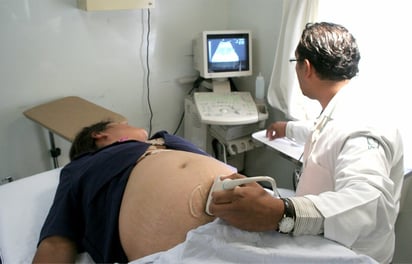 IMSS