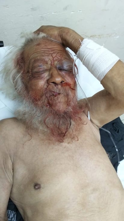 Deceso : Pese a los esfuerzos del personal médico, el hombre perdió la vida horas más tarde debido a la gravedad de las lesiones sufridas