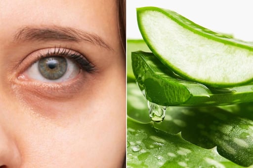 ¿Ojeras? Prueba el aloe vera y luce una mirada más fresca.  Sabemos que, por más que lo intentemos, a veces el cansancio se nota en nuestro rostro. Pero