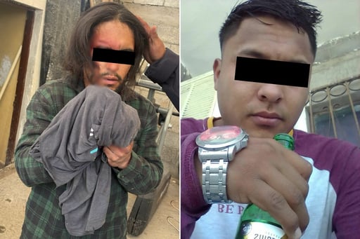 AIC esclarece cómo ocurrió la agresión.  Tras las primeras indagatorias realizadas por la Agencia de Investigación Criminal (AIC) sobre el hombre que terminó