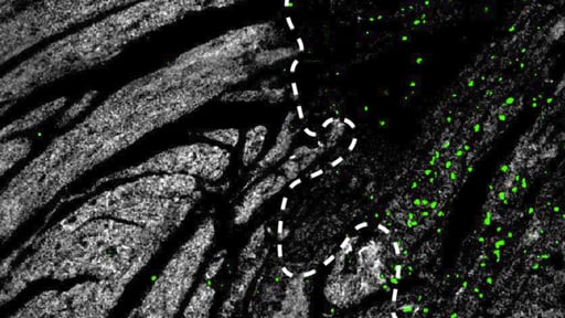 Una investigación liderada por científicos españoles ha descubierto un hallazgo importante en cardiología: los infartos que ocurren durante la noche generan