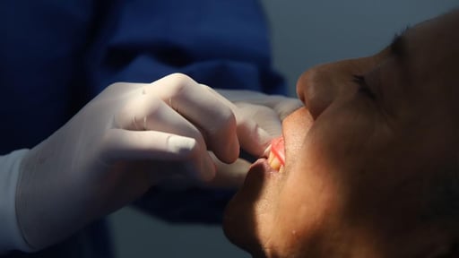 El cuidado de la salud bucal en México suele descuidarse desde etapas tempranas, incluso antes de que aparezca el dolor. Muchas caries avanzan durante meses