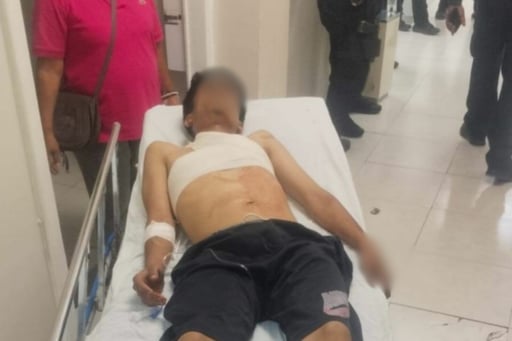 El responsable logró escapar de las autoridades.  Un joven terminó con lesiones de consideración luego de ser atacado con arma blanca la noche del viernes