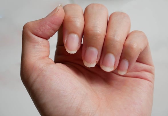 BELLEZA Descubre por qué las uñas se vuelven amarillas y cómo puedes prevenirlo con simples cambios en tu rutina de cuidado personal.  Las uñas amarillas