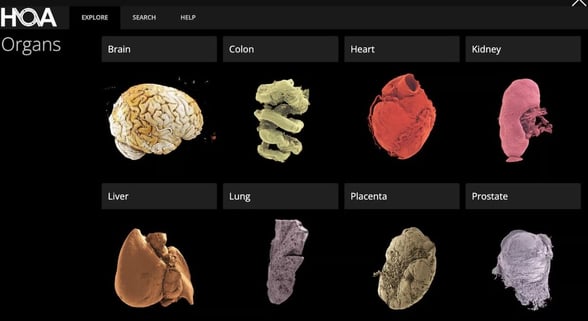 ENFERMEDADES Un grupo internacional de investigadores presentó un atlas digital tridimensional de órganos humanos, una plataforma que permite examinar en 3D estructuras