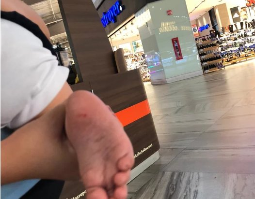 Bebé termina con alfiler en pie en una zapatería del Mall