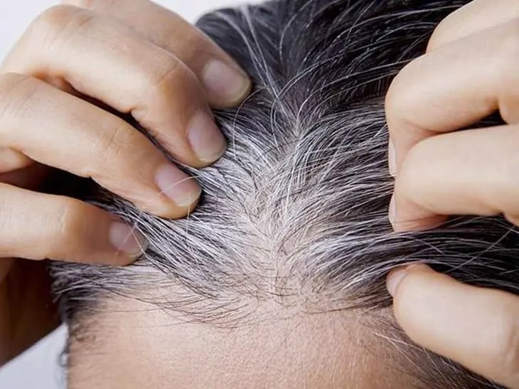 ¡Adiós a las canas! Científicos revelan cómo eliminarlas de forma definitiva