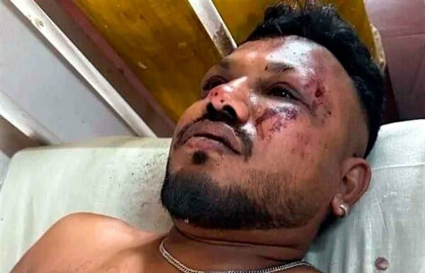 Sobrevive al avionazo:Treinta segundos después del despegue,'escuché un fuerte ruido y el avión se estrelló. Todo sucedió rapidísimo'