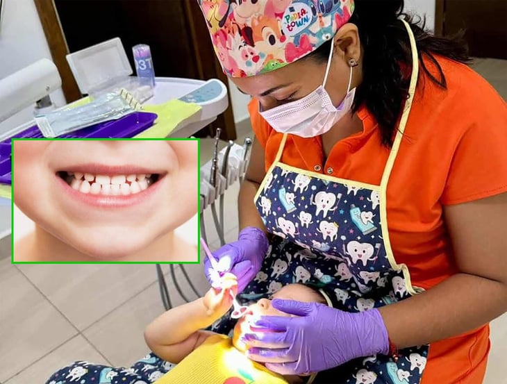 Crece bruxismo infantil por cambios estacionales y rechinar de dientes