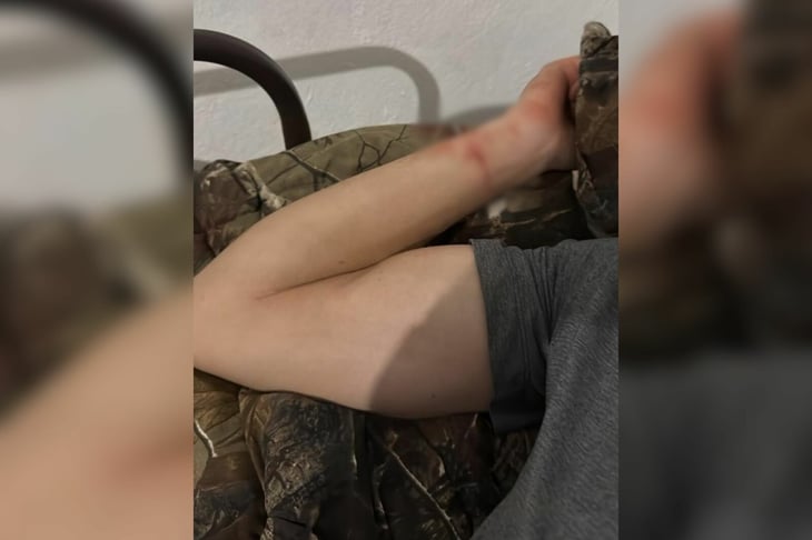 Joven atenta contra su vida por ruptura amorosa en Castaños