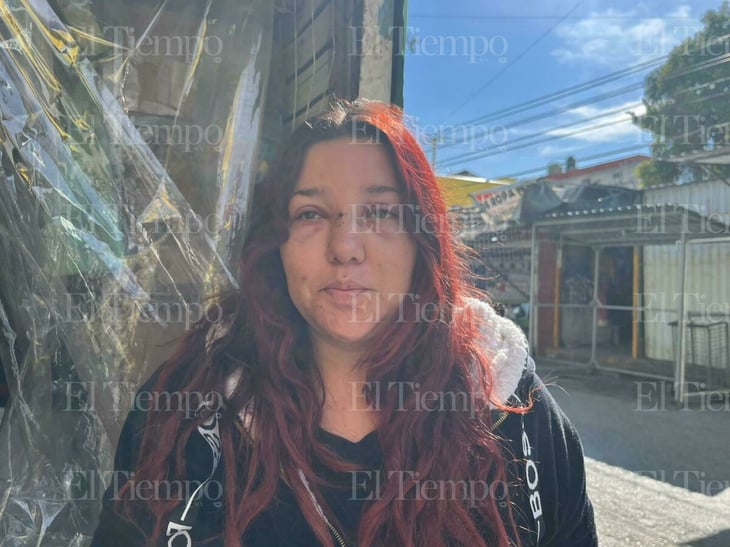 Mujer que sufrió agresión violenta en el Centro de Monclova expone clima de temor