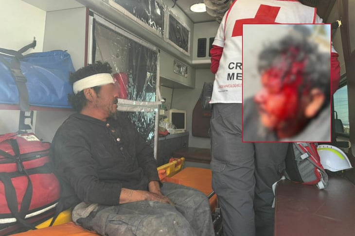 Bañando en sangre término un hombre tras ser golpeado por su primo en Monclova