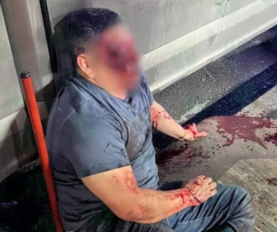Dos personas fueron turnadas ante el MP por protagonizar pelea