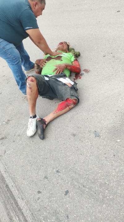 Muere tras carreterazo en la federal 2