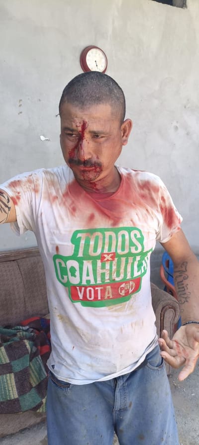 Lo dejan como el caballo blanco y lo llevan al bote