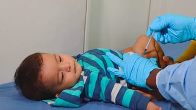 Brote de sarampión alarma a PN: 2 casos confirmados y 2 sospechos