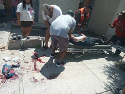 Ataque de pitbull deja dos mujeres heridas en Monclova