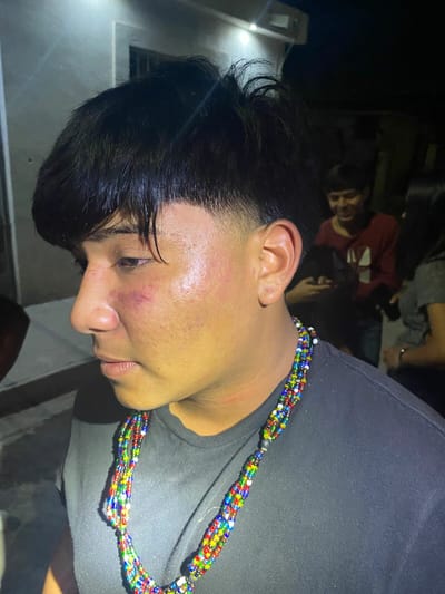 'Lagartones' abusivos golpean a jovencito