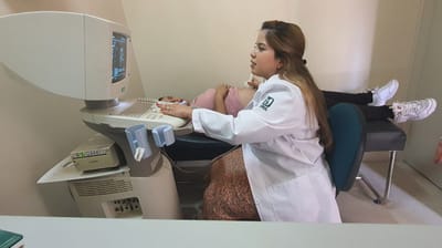 Atiende IMSS Coahuila casos de placenta acreta