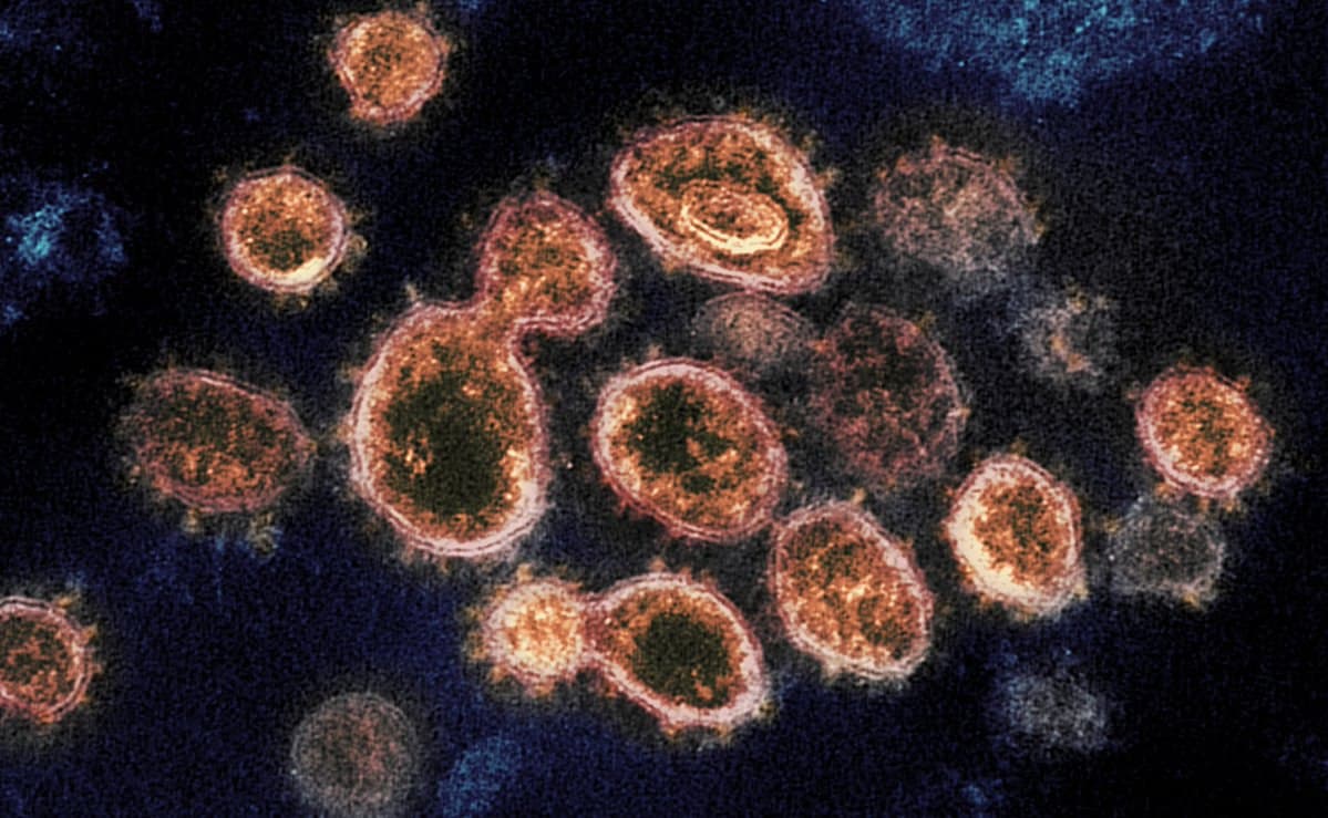 ¡Buenas noticias! Descubren forma de disminuir la gravedad del COVID-19: La actuación de unas células puede ser determinante a la hora de enfermarse por el virus