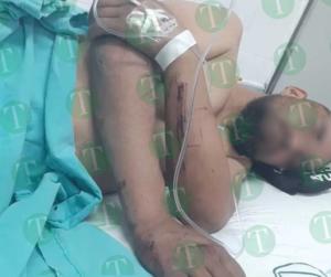Raúl fue arrollado por camión de Castaños  y su familia pide apoyo para sobrevivir
