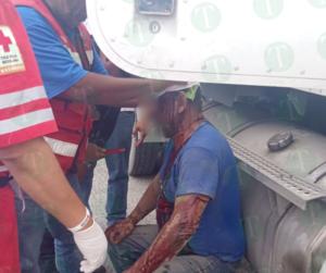 Chofer queda bañado en sangre tras accidente en la carretera 53