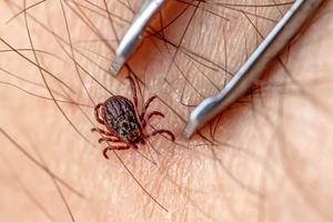 Se tiene el registro de seis fallecimientos por rickettsiosis