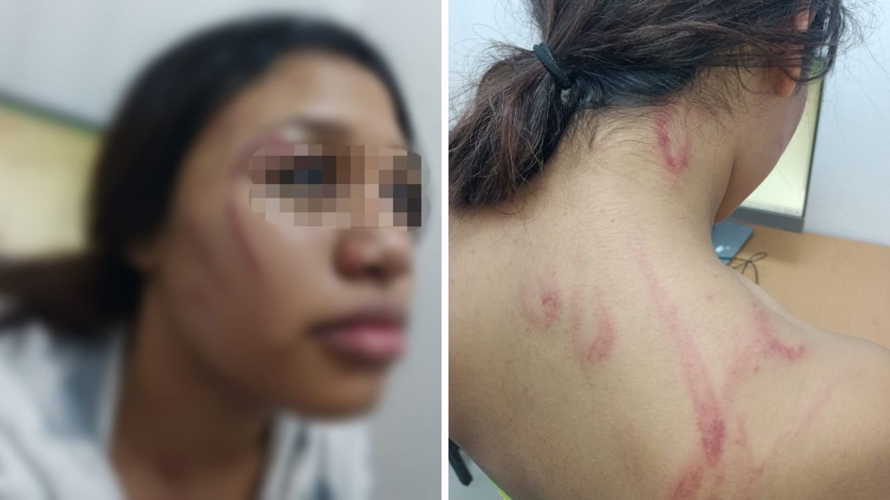 Nuevo León: La menor, de 14 años, sufrió lesiones visibles en diversas partes del cuerpo tras los golpes.

