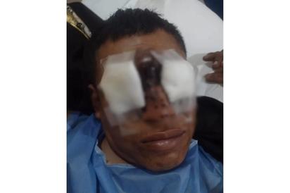 Médicos salvan la vista de Miguel Palacio tras accidente con pirotecnia