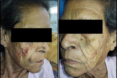 Con ojos tristes, una madre golpeada decide proteger a su hijo agresor