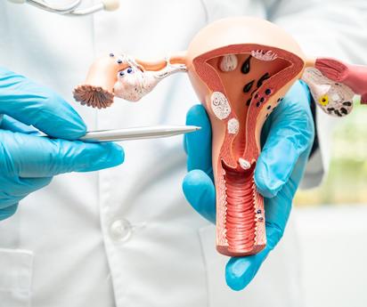 El cáncer cervical y su relación con el VPH: Cómo protegerte