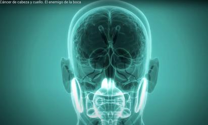 El tabaco, el alcohol y el virus del papiloma humano, principales causas del cáncer de cabeza y cuello