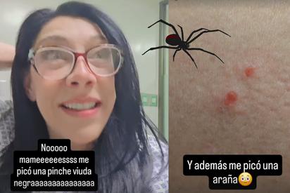 Cynthia Klitbo hospitalizada tras el ataque de una Viuda Negra