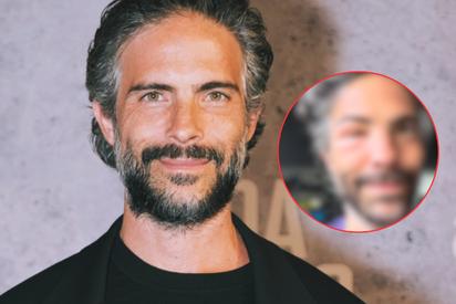 Osvaldo Benavides sorprende con el rostro desfigurado y su reacción desata risas