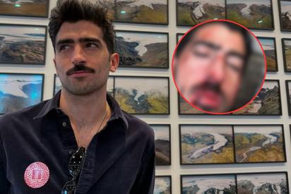 ¡Jezzini ensangrentado! Su última publicación tiene a todos preguntándose qué pasó 