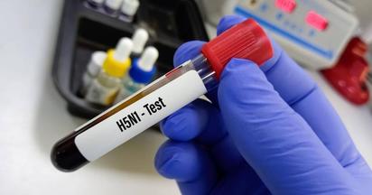 Confirman primer caso de influenza aviar H5N1 en niña de 3 años en México