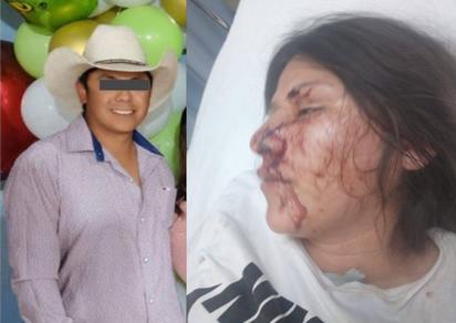  Silvia Paulina sobrevive de brutal golpiza y buscan a su agresor 