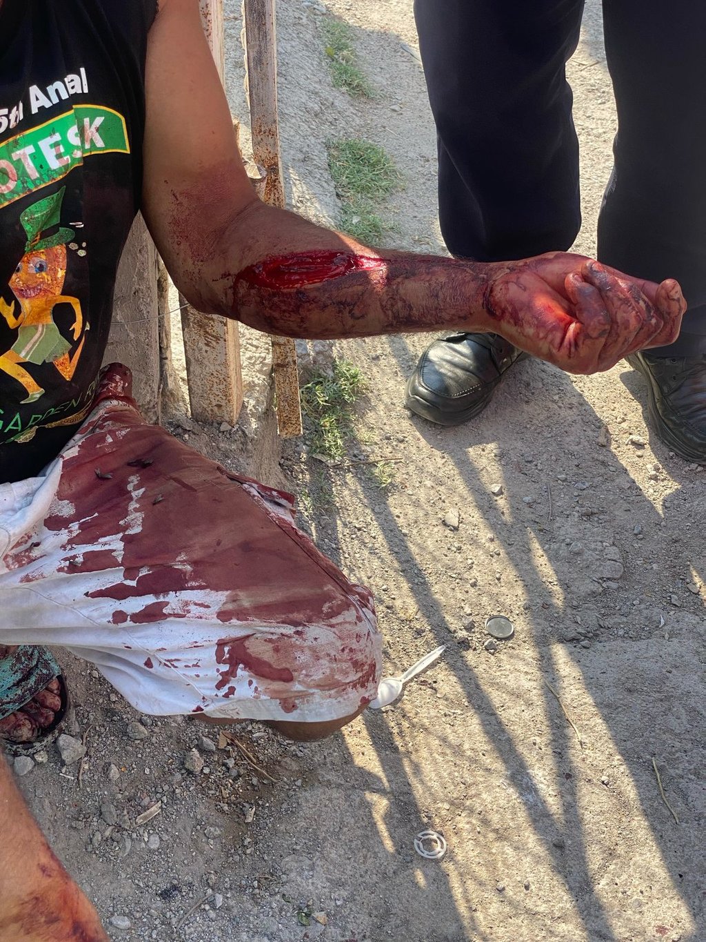 seguridad: Casi se amputa brazo con la herida.