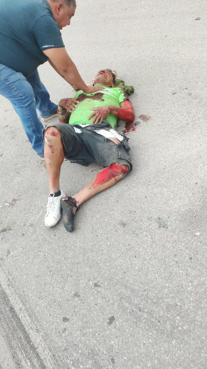 Muere tras carreterazo en la federal 2