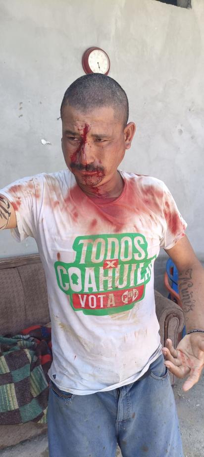 Lo dejan como el caballo blanco y lo llevan al bote