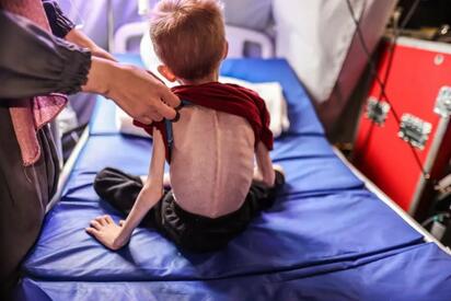 ONU alerta: Gaza enfrenta hambruna infantil severa