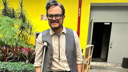 Aleks Syntek sufre caída en casa y termina con el pie fracturado